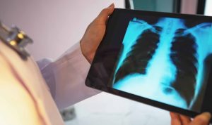 Viz.ai companions with Regeneron, Sanofi to review COPD software